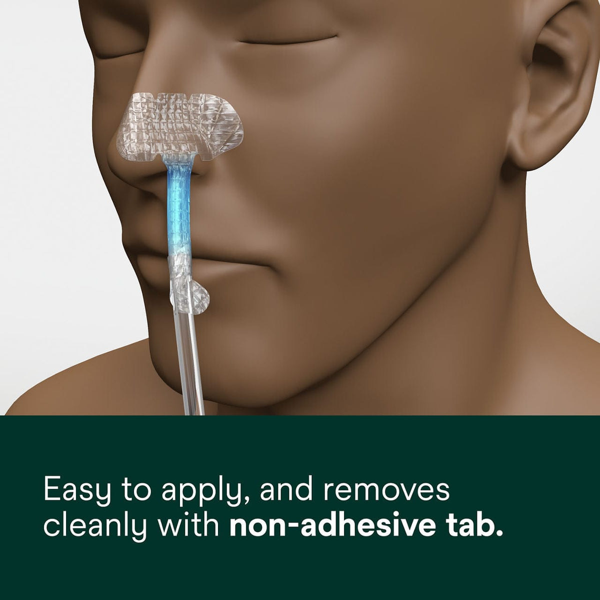 3M Nasogastric Securement Device 1501NG Large