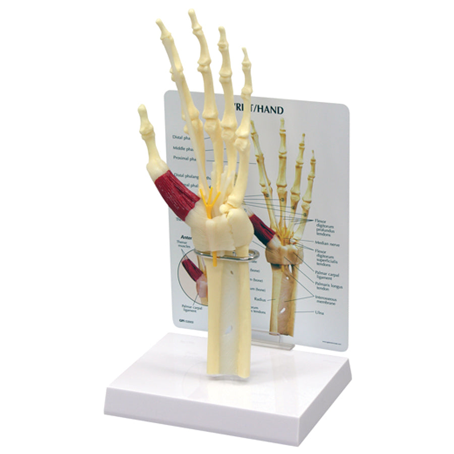 Full-Size Hand & Wrist Model — Carpal Tunnel Anatomy (Solid Cast)