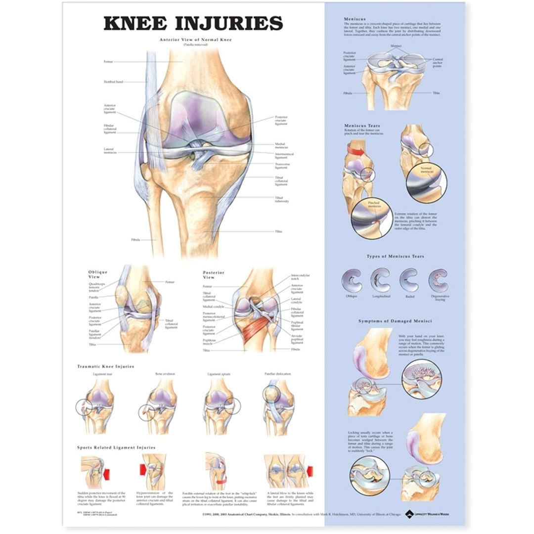 Knee Injuries Anatomical Chart — Detailed Knee Anatomy & Injury Guide