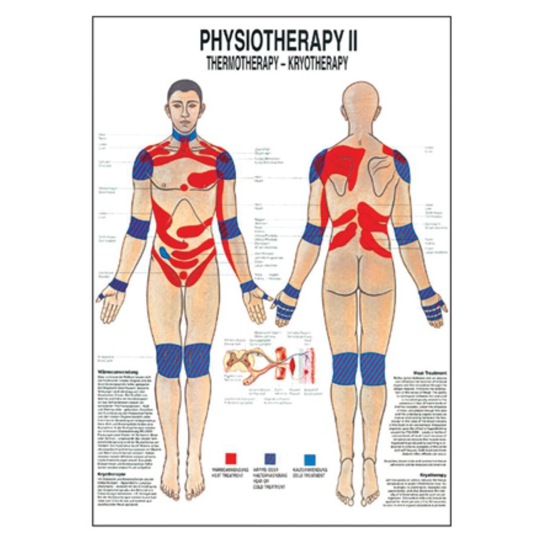Thermotherapy Charts — Clinical Reference Series for Physiotherapists