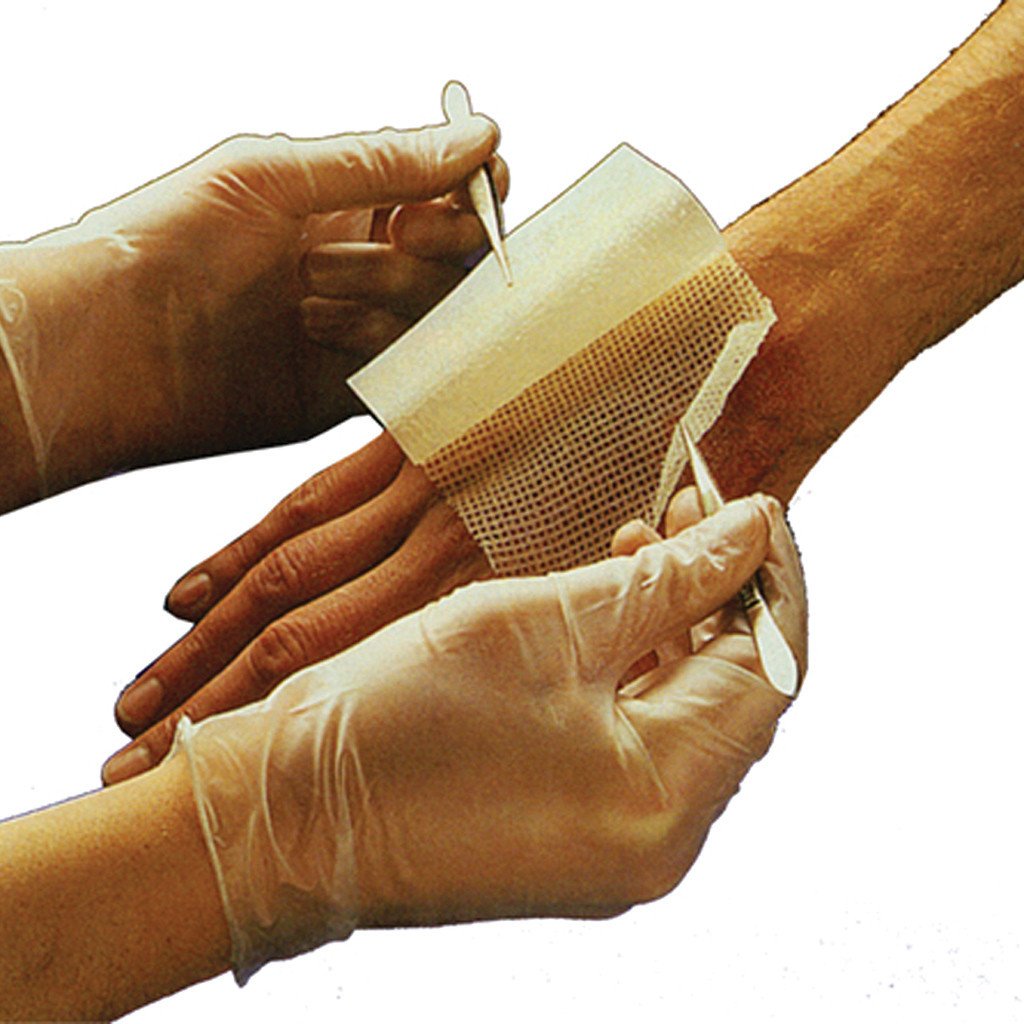 Jelonet Sterile Paraffin Tulle Gras Dressing — Low-Adherence Wound Con