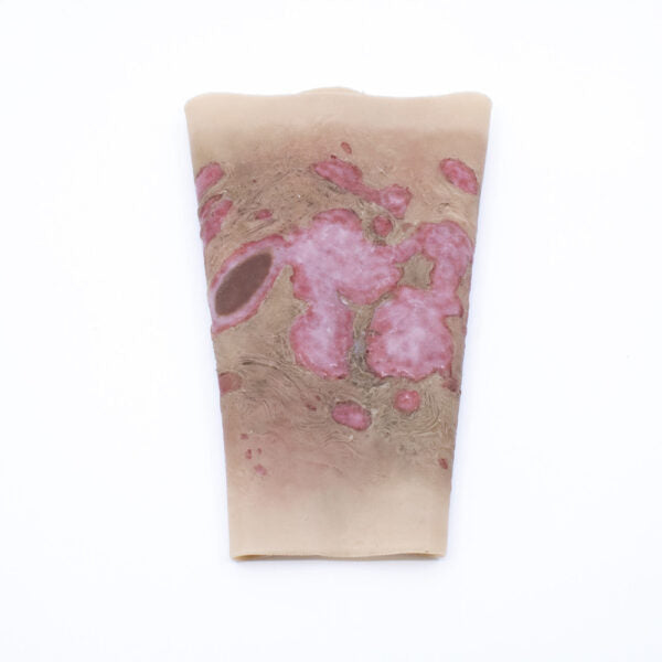 Burn Injury Training Model – First Aid Trauma Simulation Aid
