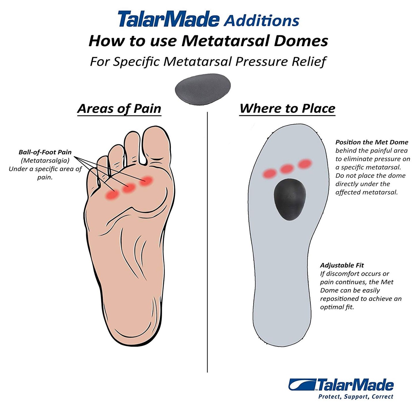 Talarmade Trio Metatarsal Domes (Met Domes) - MicroGrip