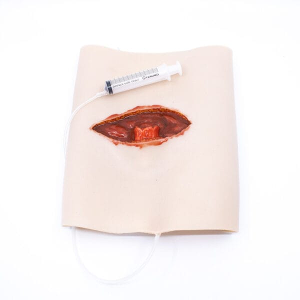 Femur Fracture Training Model – Emergency Trauma Training Aid