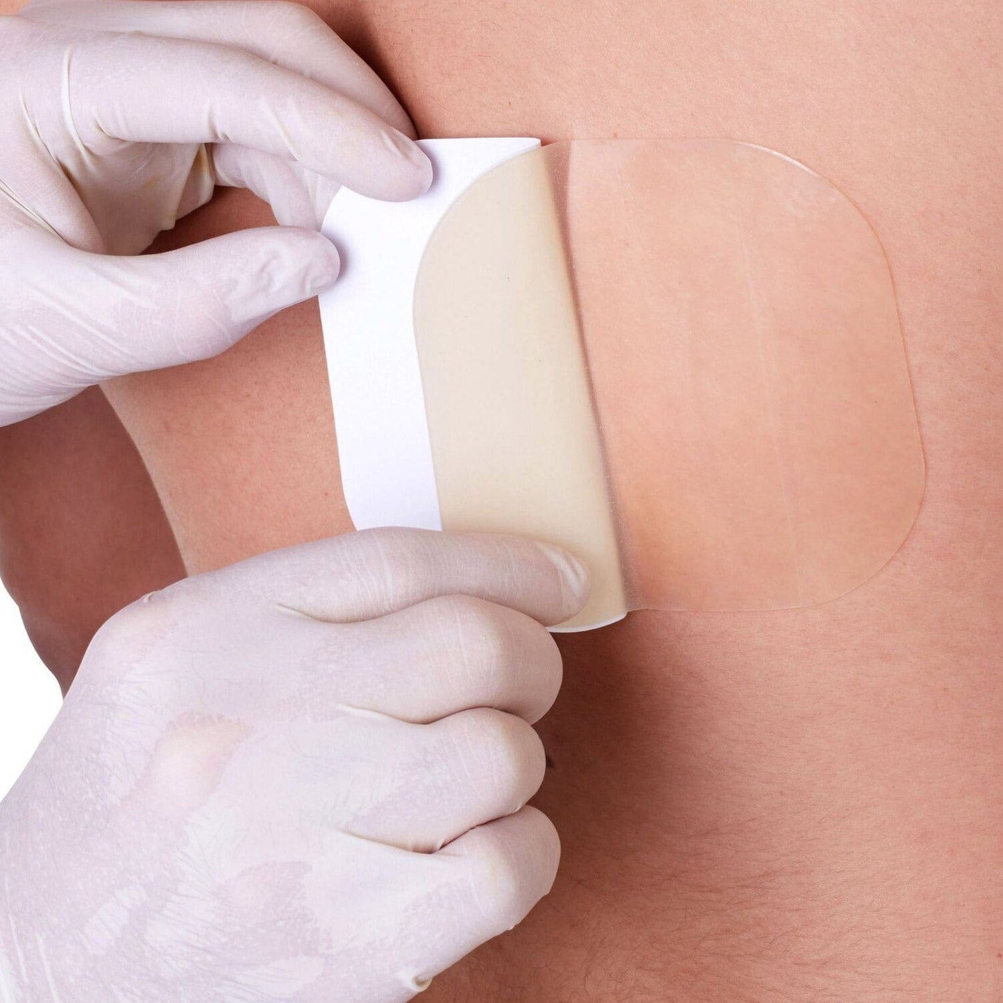 Hydrocolloid Dressing 10cm x 10cm