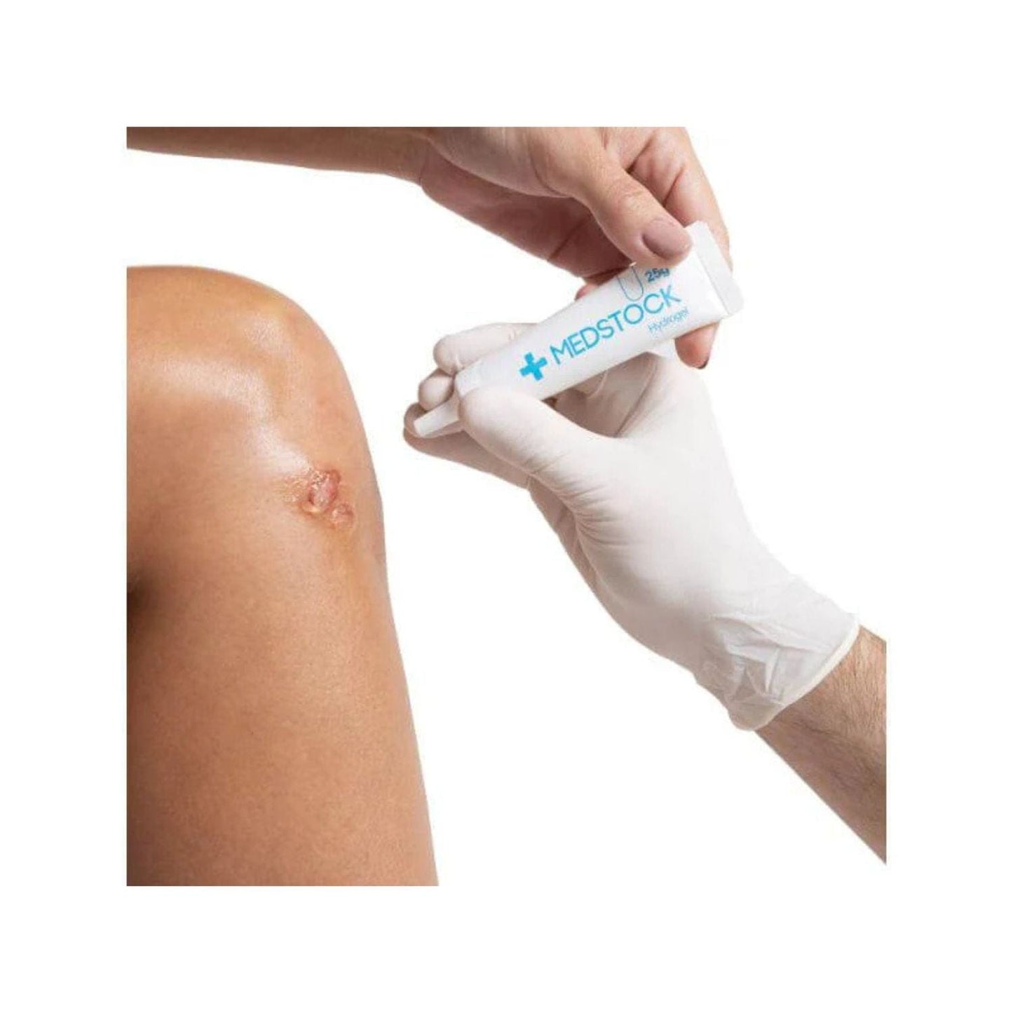 Medstock Hydrogel Amorphous Tube