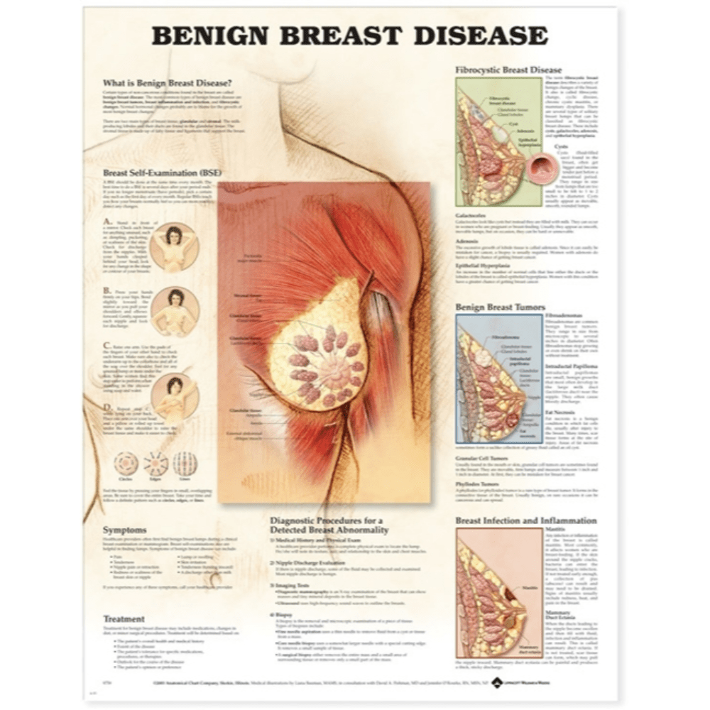 Anatomical Chart Company Anatomical Charts Benign Breast Disease Anatomical Chart