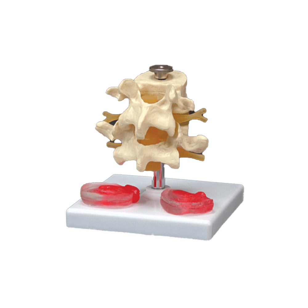 Anatomical Chart Company Anatomical Model Budget Lumbar Vertebrae With Interchangeable Discs