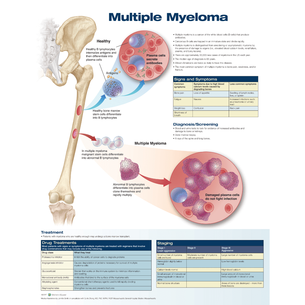 Anatomical Chart Company Anatomical Charts Multiple Myeloma
