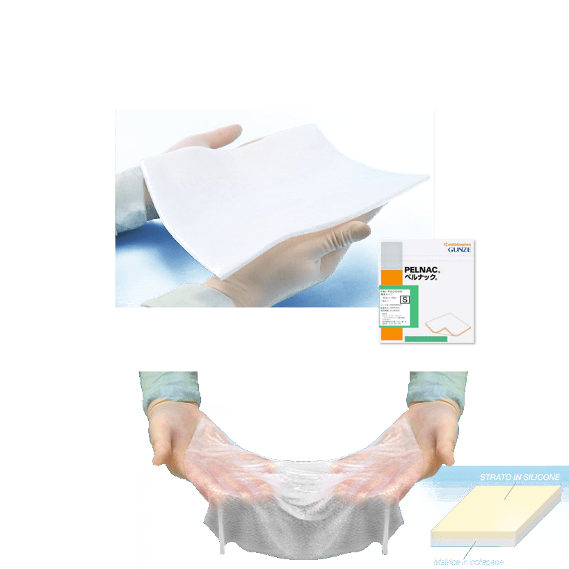 Smith & Nephew Pelnac Artificial Dermal Substitute