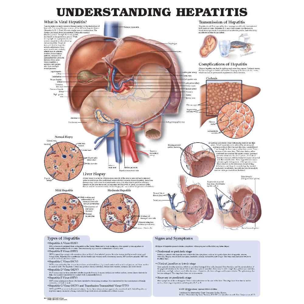 Anatomical Chart Company Anatomical Charts Understanding Hepatitis Anatomical Chart