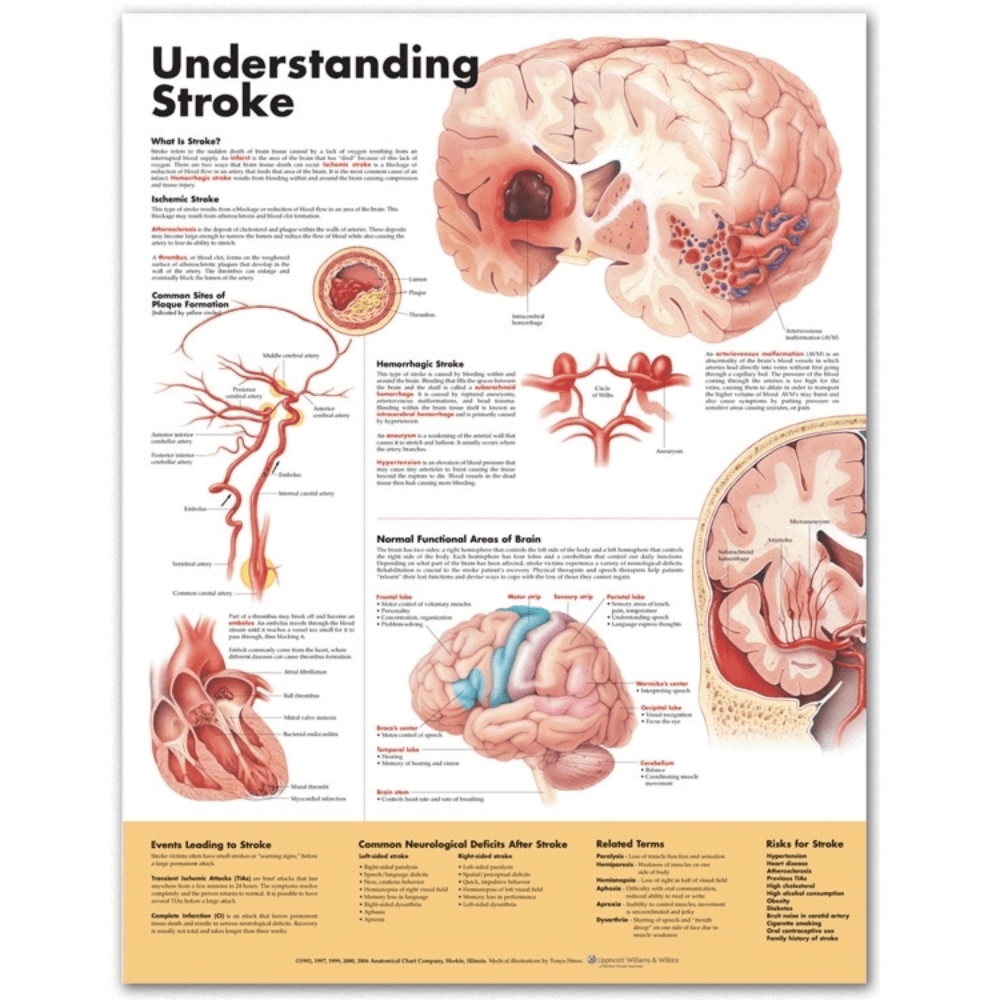 Anatomical Chart Company Anatomical Charts Understanding Stroke Anatomical Chart