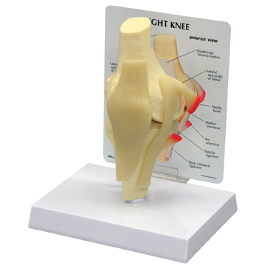 Full-Size Right Knee Anatomy Model — Ligaments & Menisci (with Descrip