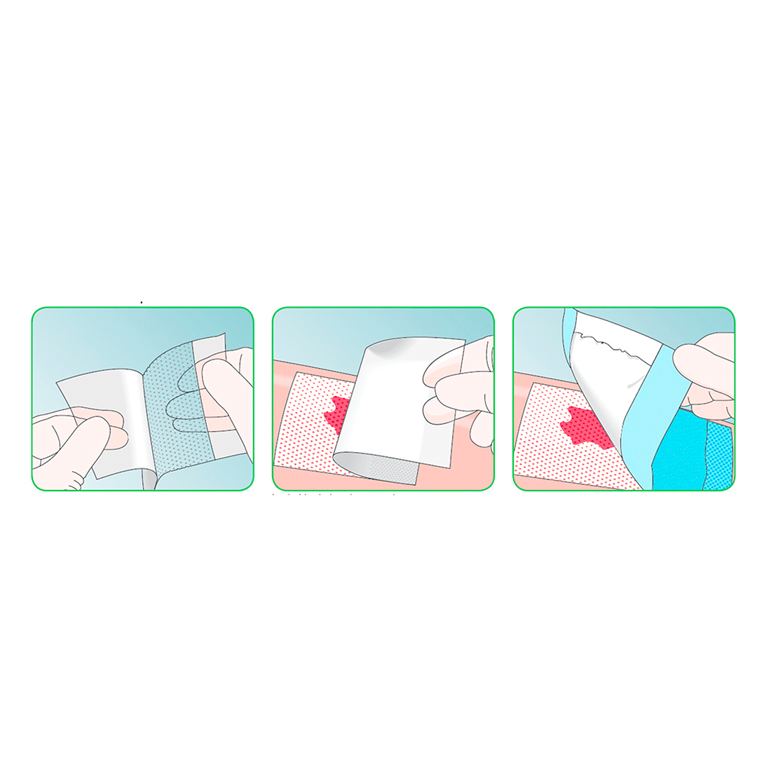 Non-adherent wound dressing for gentle dressing changes