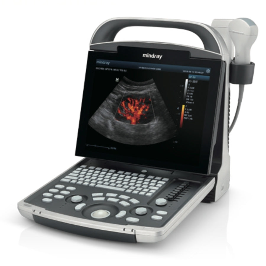 DP30 Power diagnostic ultrasound system