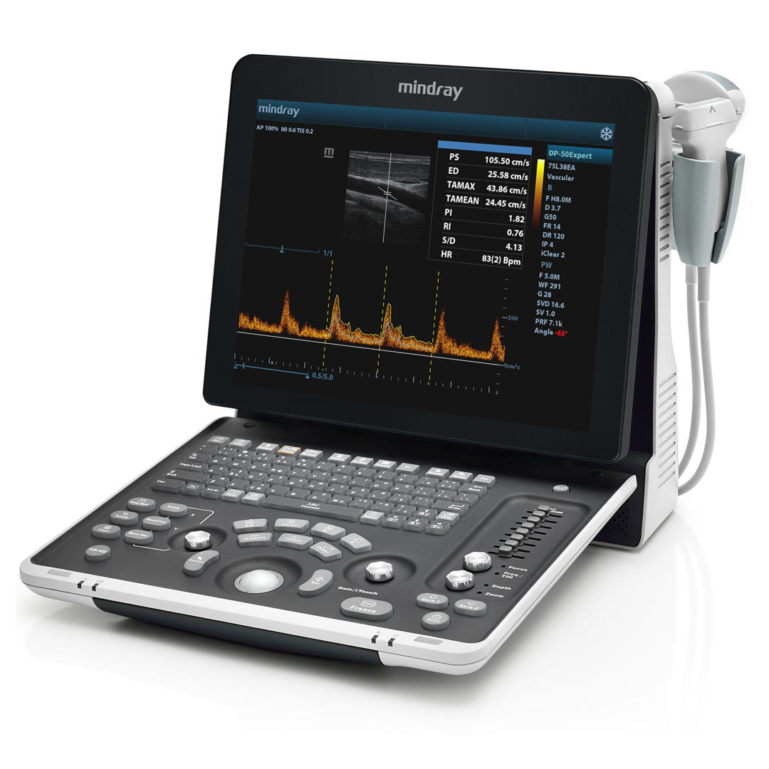 DP-50 ultrasound machine — portable diagnostic system