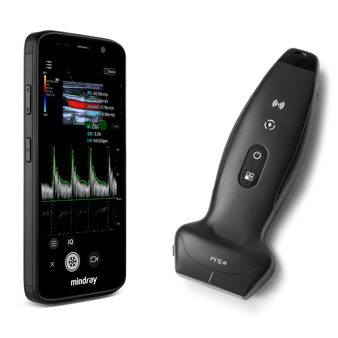 Wireless handheld ultrasound for point-of-care imaging