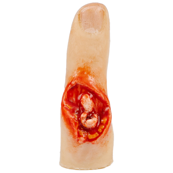 Finger Injury Trainer – Exposed Bone First Aid Training Aid