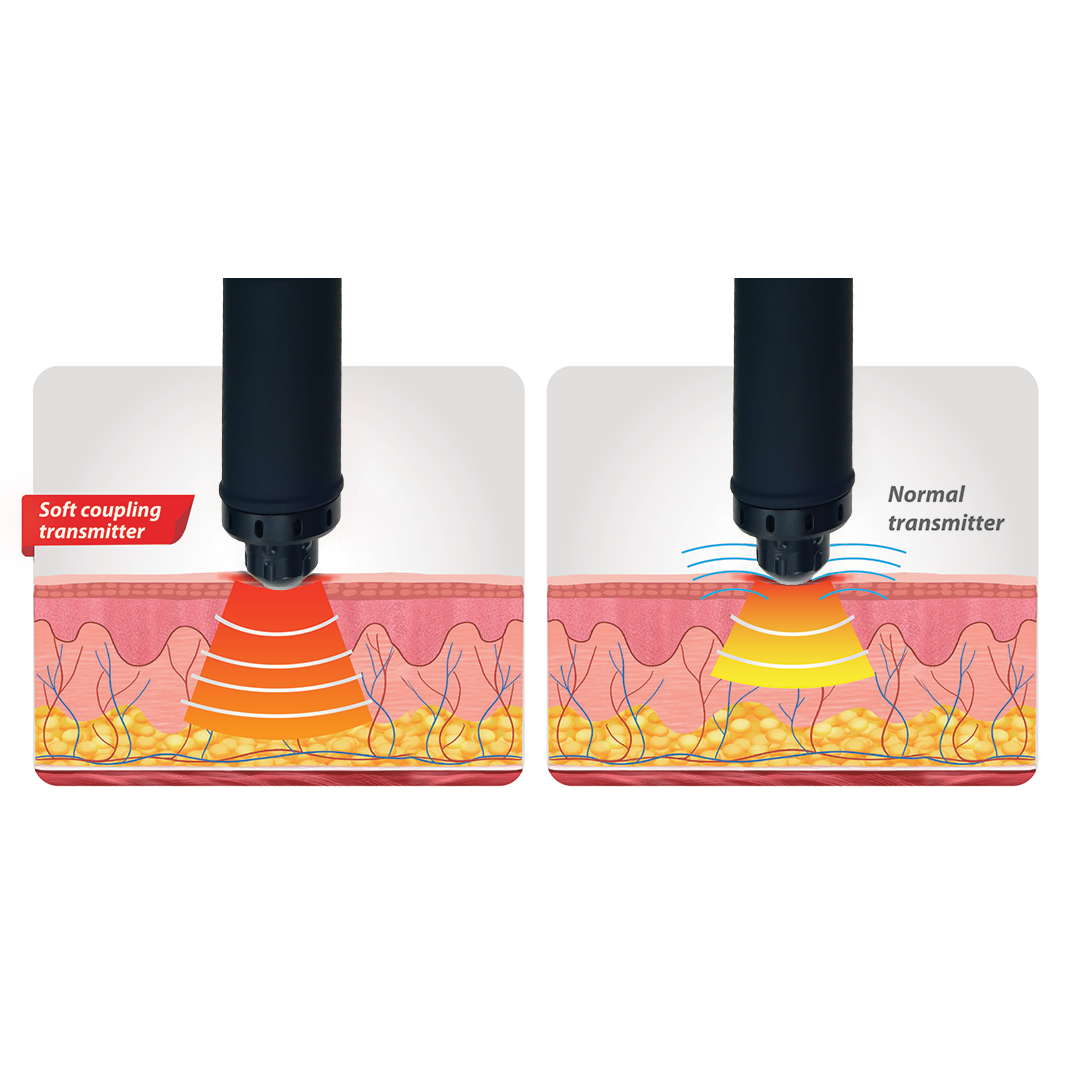 Shock Physio Unit – ESWT & EMB Two-in-One Device