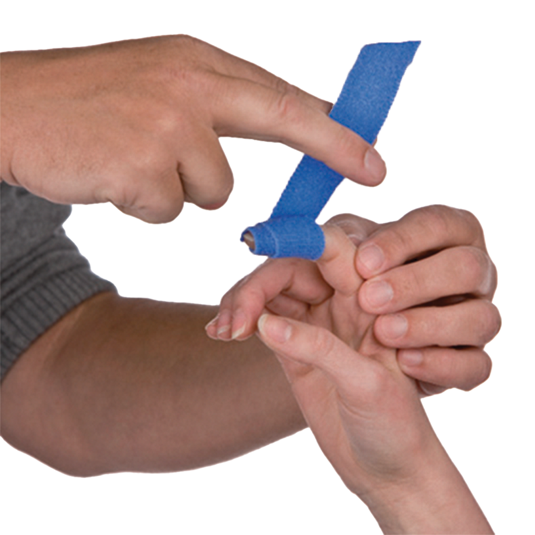 Thermoplastic tape for splinting and custom orthoses