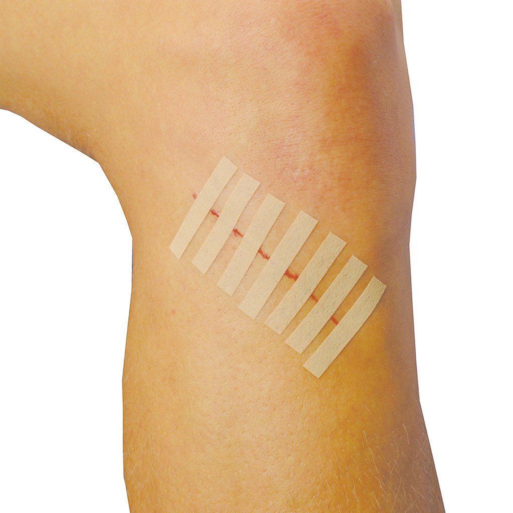 Steri Strips wound closure strips for minor cuts