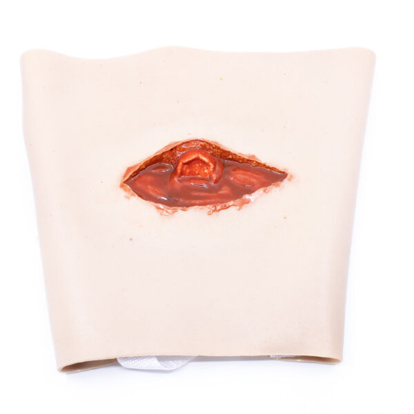 Femur Fracture Training Model – Emergency Trauma Training Aid