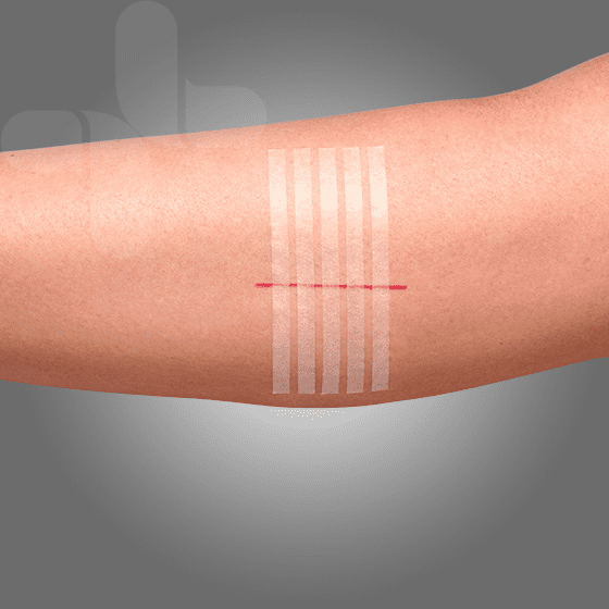 Aero Healthcare Aero Wound Closure Strips 3mm x 75mm