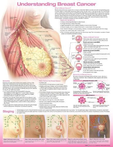 Anatomical Chart Understanding Breast Cancer 3E 2