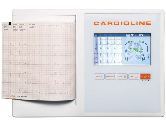 Cardioline Electrocardiographs Cardioline ECG 200S A4 With Glasgow Interpretation and PDF