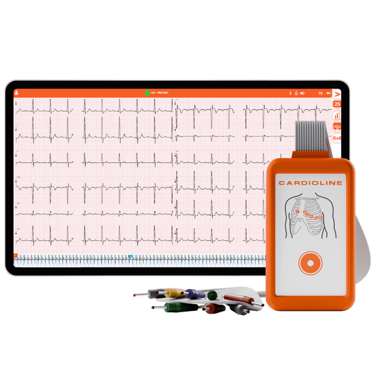 Cardioline Electrocardiographs Cardioline Touch ECG HD+ USB With Glasgow Interpretation, 12-Lead PC-ECG