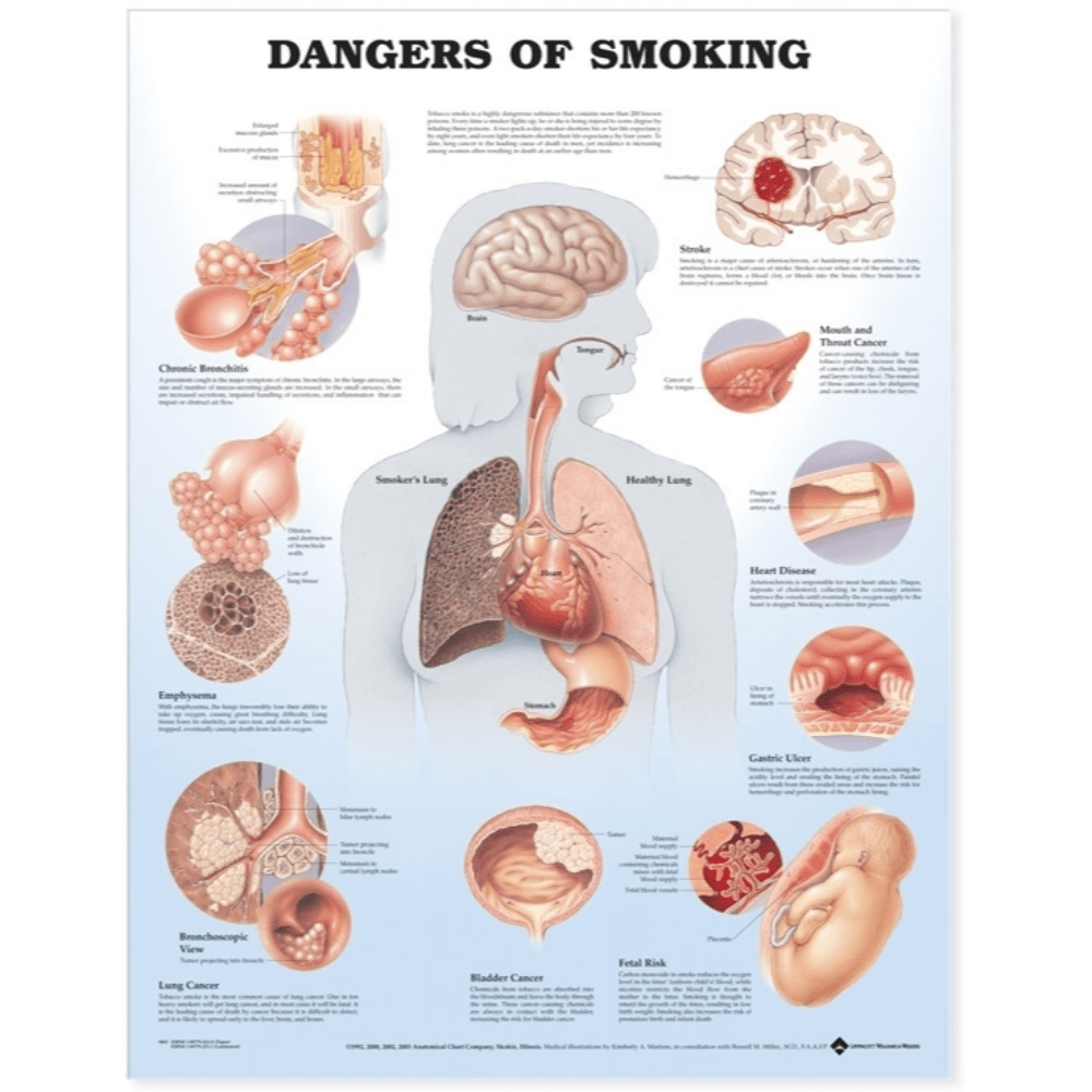 Dangers of Smoking Anatomical Chart