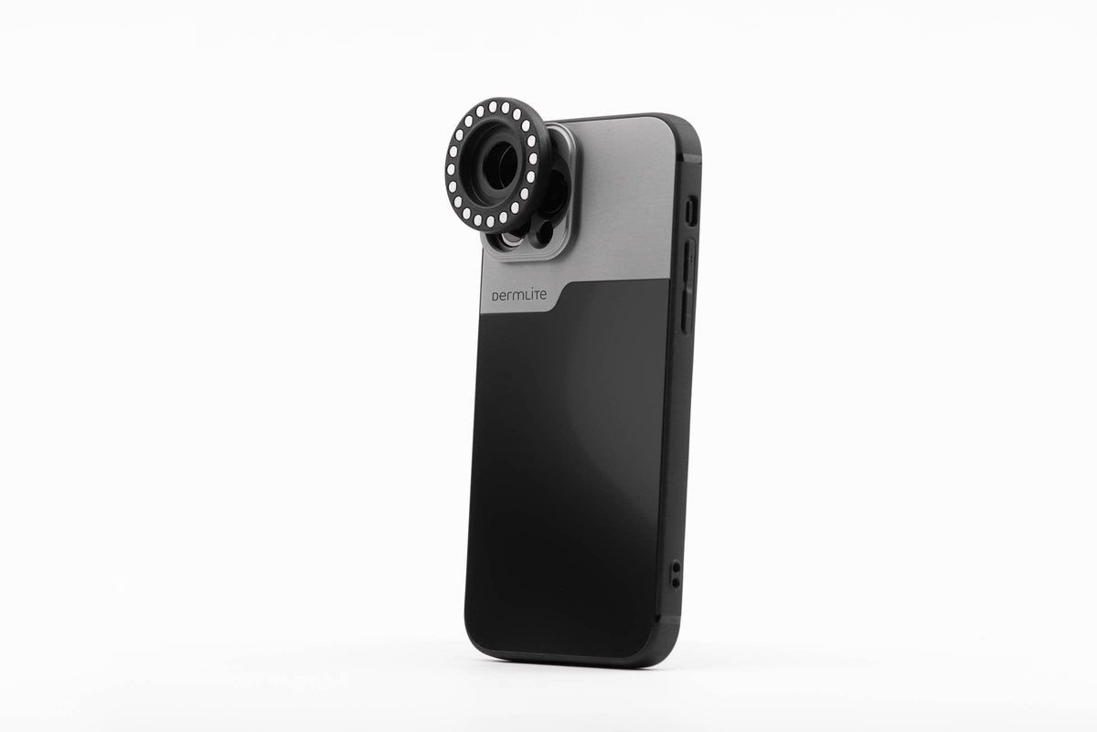 Dermlite DL Connection Kit for iPhone 14 Pro