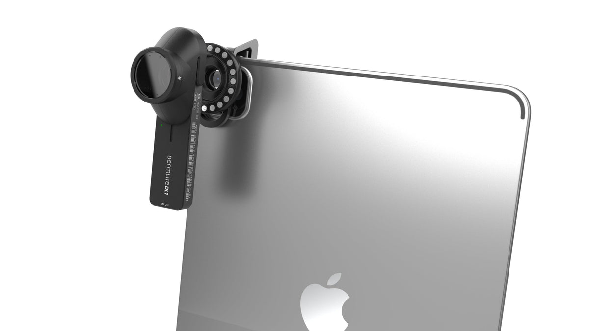 DermLite DL1 Basic Dermatoscope with MagnetiConnect Clamp Adaptor