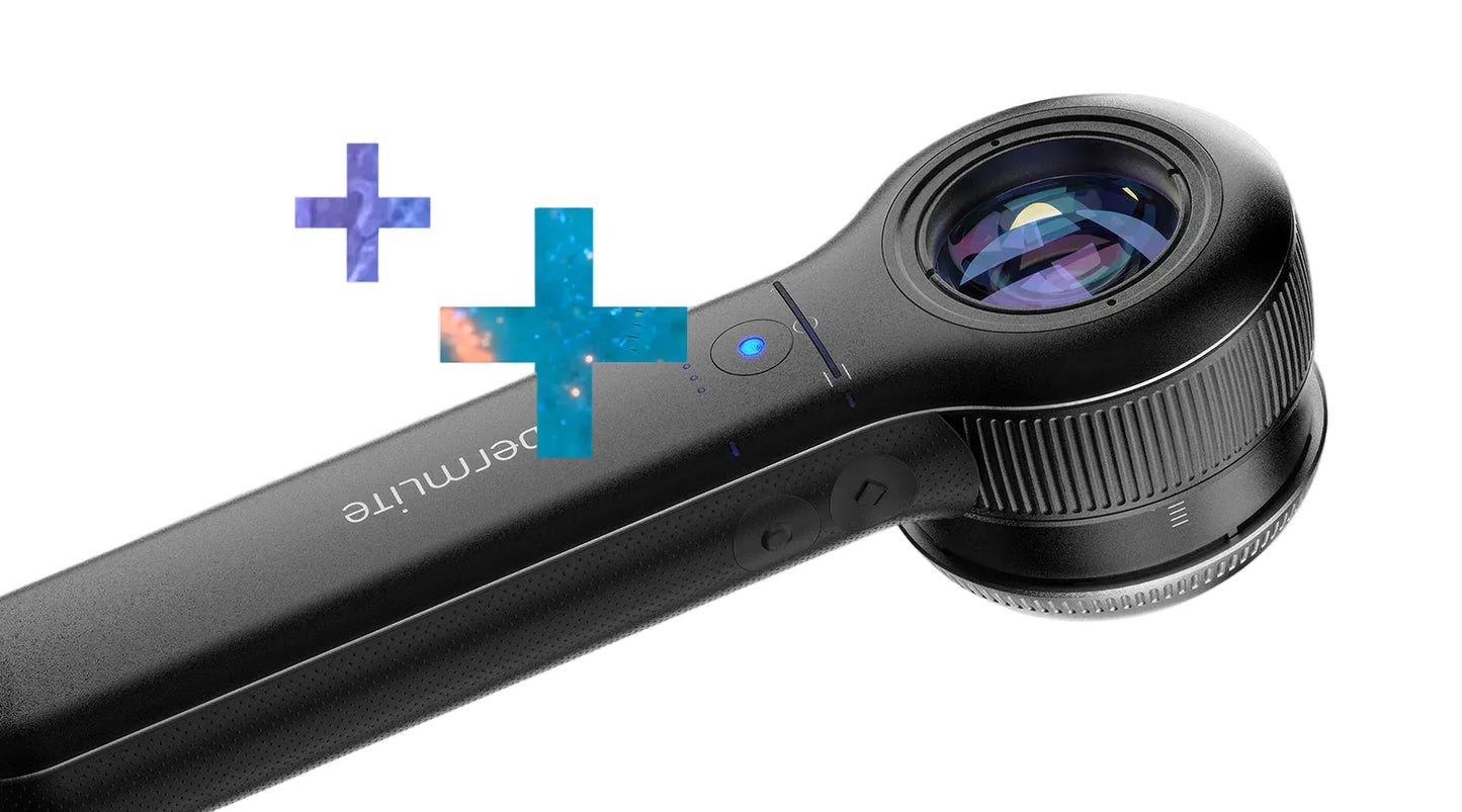 DermLite DL5 Plus Dermatoscope