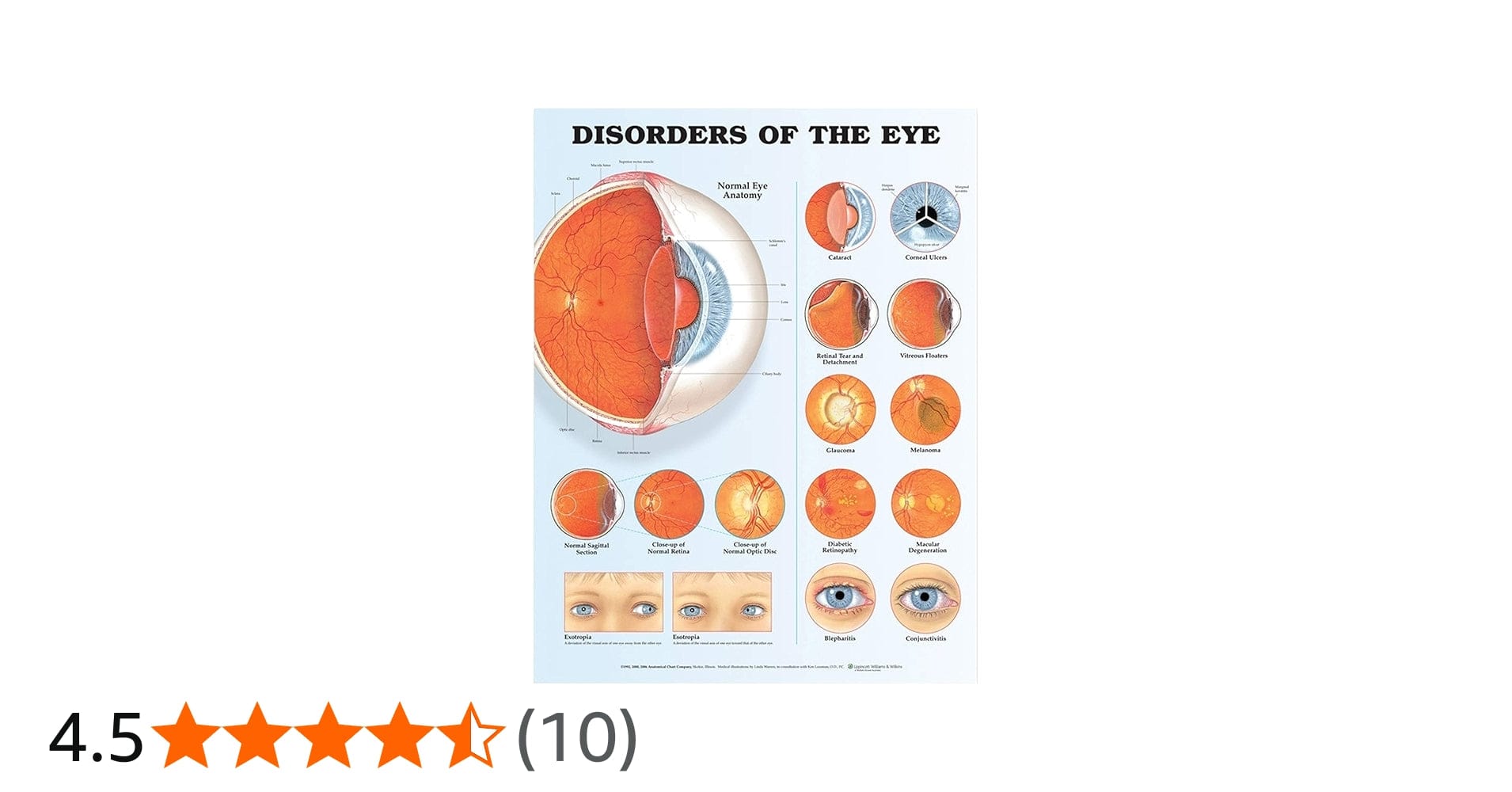 Disorders of the Eye Anatomical Chart (Laminated) 3