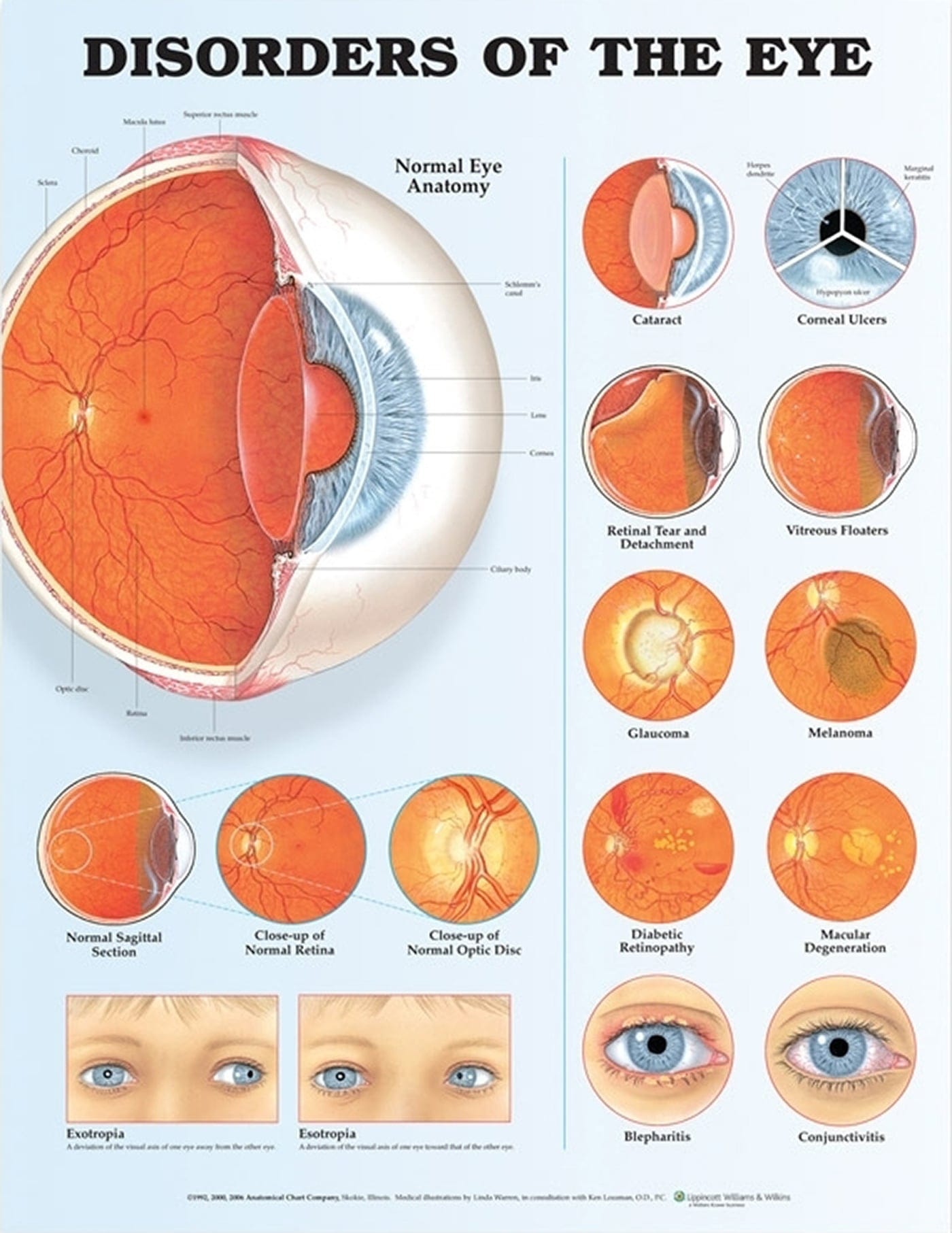 Disorders of the Eye Anatomical Chart (Laminated) 2