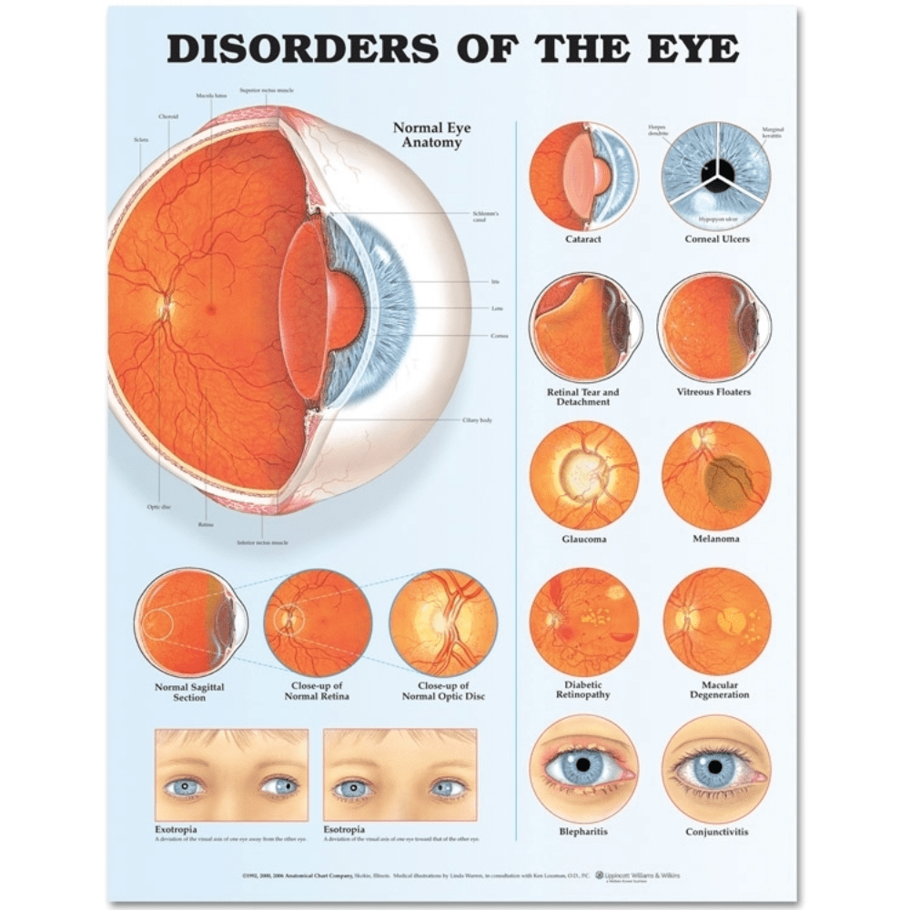 Anatomical Chart Disorders of the Eye Anatomical Chart 20 inches 1
