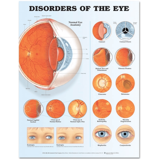 Anatomical Chart Disorders of the Eye Anatomical Chart 20 inches 1