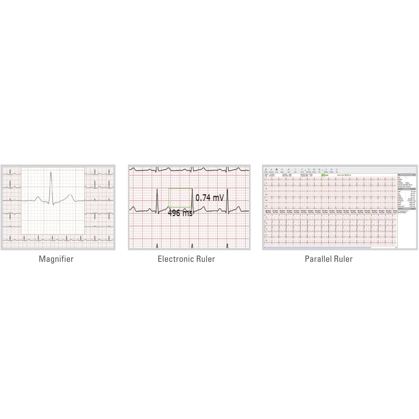 ECGMac ECGMac PC ECG Bluetooth/USB With Software for Windows PC