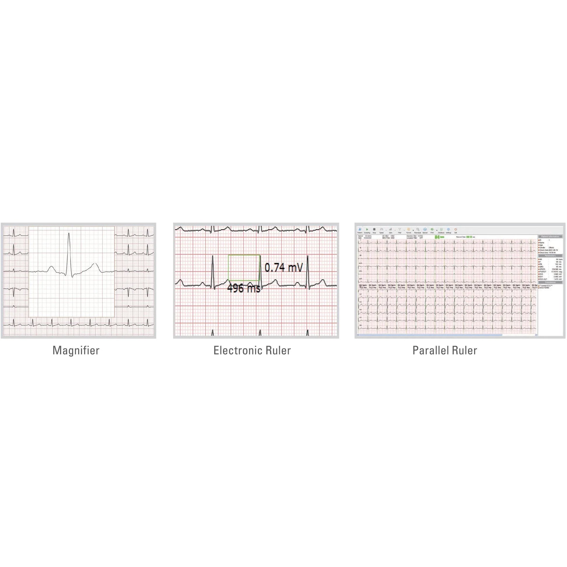 ECGMac ECGMac PC ECG Bluetooth/USB With Software for Windows PC