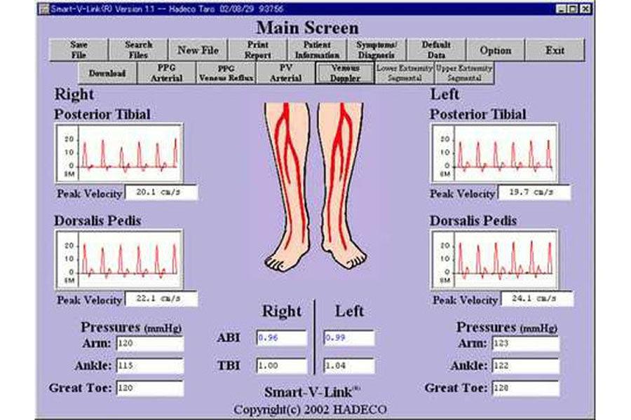 Hadeco Smart-V-Link Software Version 2
