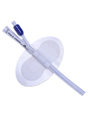 MDevices Catheter Securement Device