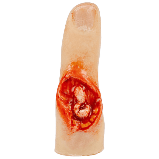 TraumaSim Finger Glove - Exposed Bone Injury