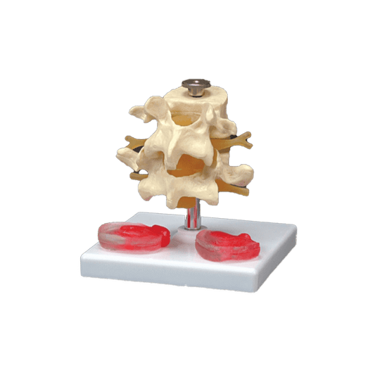 Anatomical Chart Company Anatomical Model Budget Lumbar Vertebrae With Interchangeable Discs