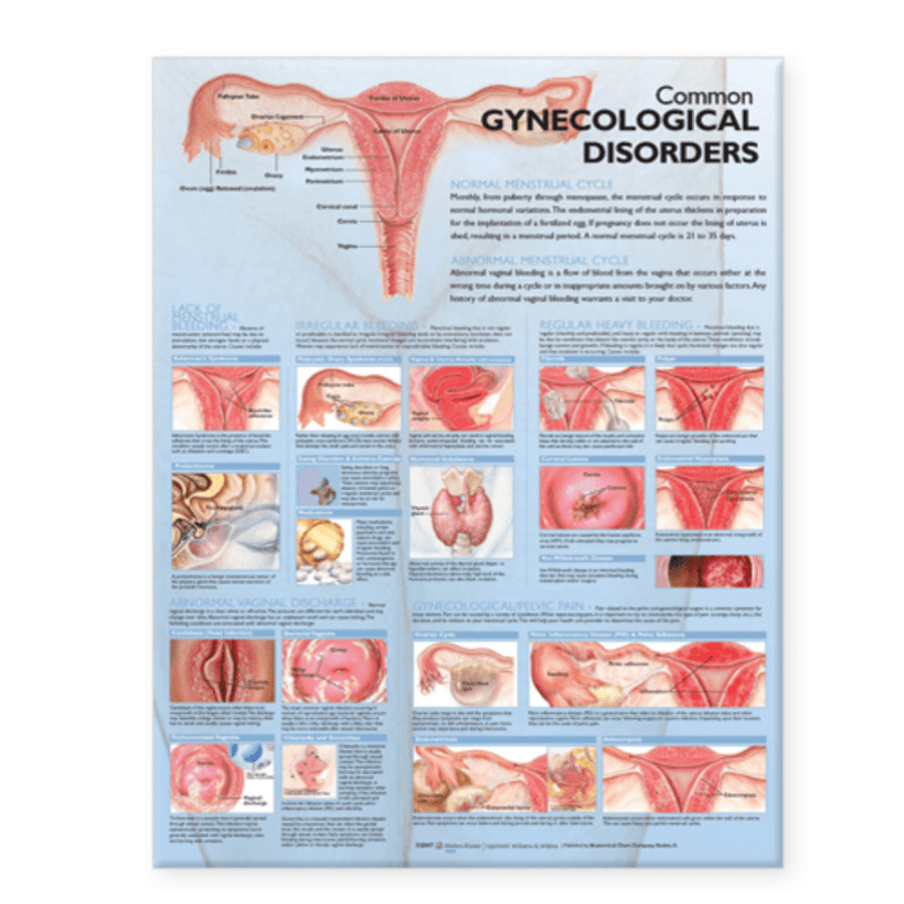 Common Gynecological Disorders Anatomical Chart – Medshop Australia