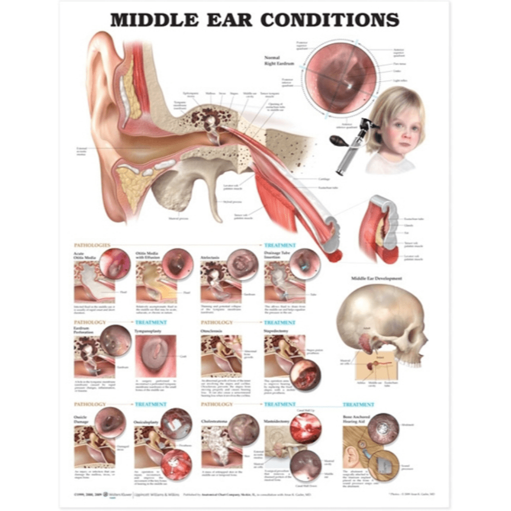Anatomical Chart Company Anatomical Charts Middle Ear Conditions Anatomical Chart