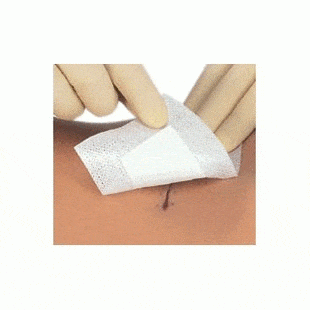 Smith & Nephew Cutiplast Steril Island Dressing